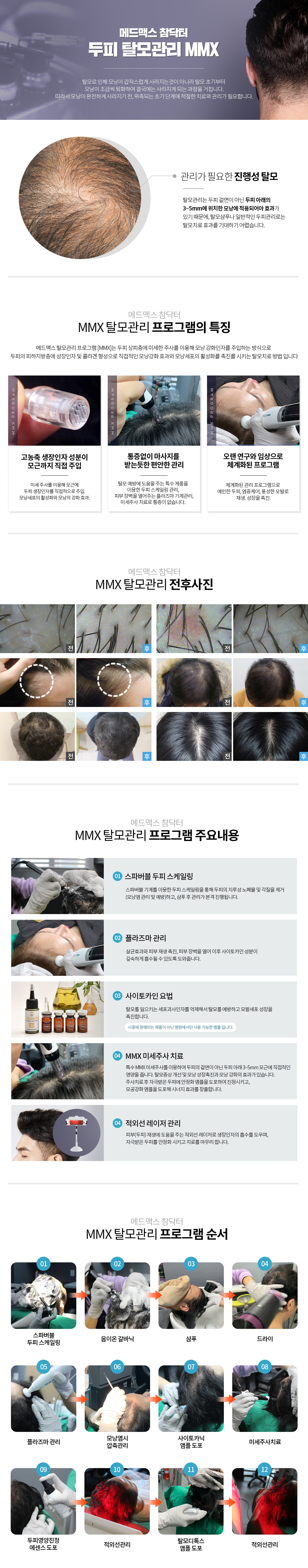 참닥터의 치료효과